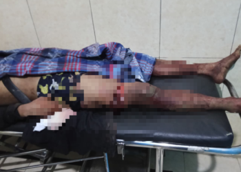 Tragis Pembunuhan Sadis di Cikalong Pandeglang Medi Hingga Tewas
